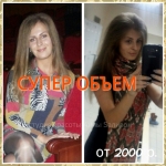 Прикорневой обьем во Владимире